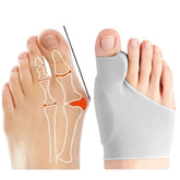 Correcteur Hallux Valgus en Gel Souple – Soulage et Corrige Naturellement les Oignons du Pied 👣